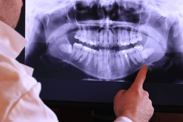 Best Emergency Tooth Extraction in Savannah, GA