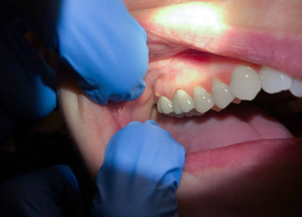 Best Pediatric Emergency Dentist in Savannah, GA