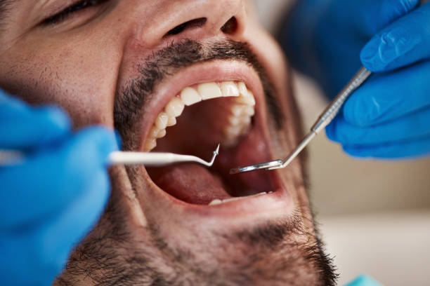 Best Emergency Treatment for Toothache in Savannah, GA