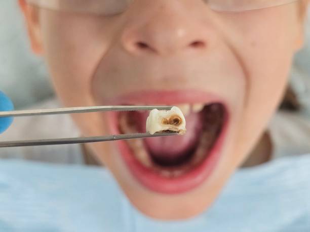 , GA Emergency Dentist Company